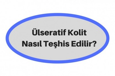Ülseratif Kolit  Hastalığı Nedir? Belirtileri ve Tedavi Yöntemleri 