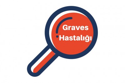 Graves Hastalığı Nedir Neden Olur? Belirtileri ve Tedavi Yolları