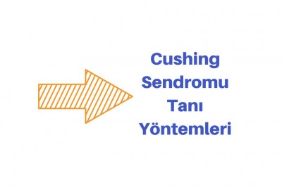 Cushing Sendromu Nedir Tedavi Edilmezse Ne Olur? Belirtileri ve Tanısı