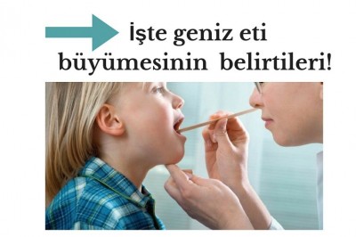 Geniz eti (adenoid) nedir neden büyür? Geniz eti teşhisi ve tedavisi