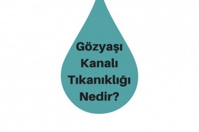 Gözyaşı Kanalı Tıkanıklığı Neden Olur? Belirtileri ve Tedavisi