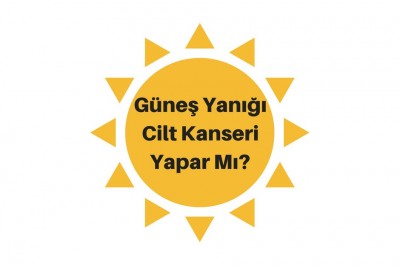 Güneş Yanığı Neden Olur Nasıl Geçer? Güneş Yanığının Belirtileri ve Tedavisi