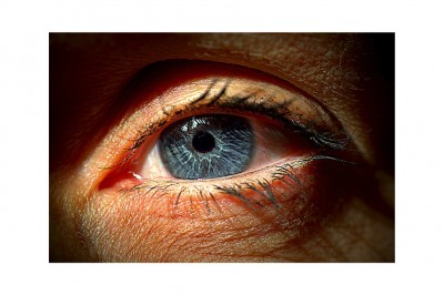 Göz alerjisi nedenleri ve belirtileri nelerdir? Göz alerjisi türleri ve tedavisi